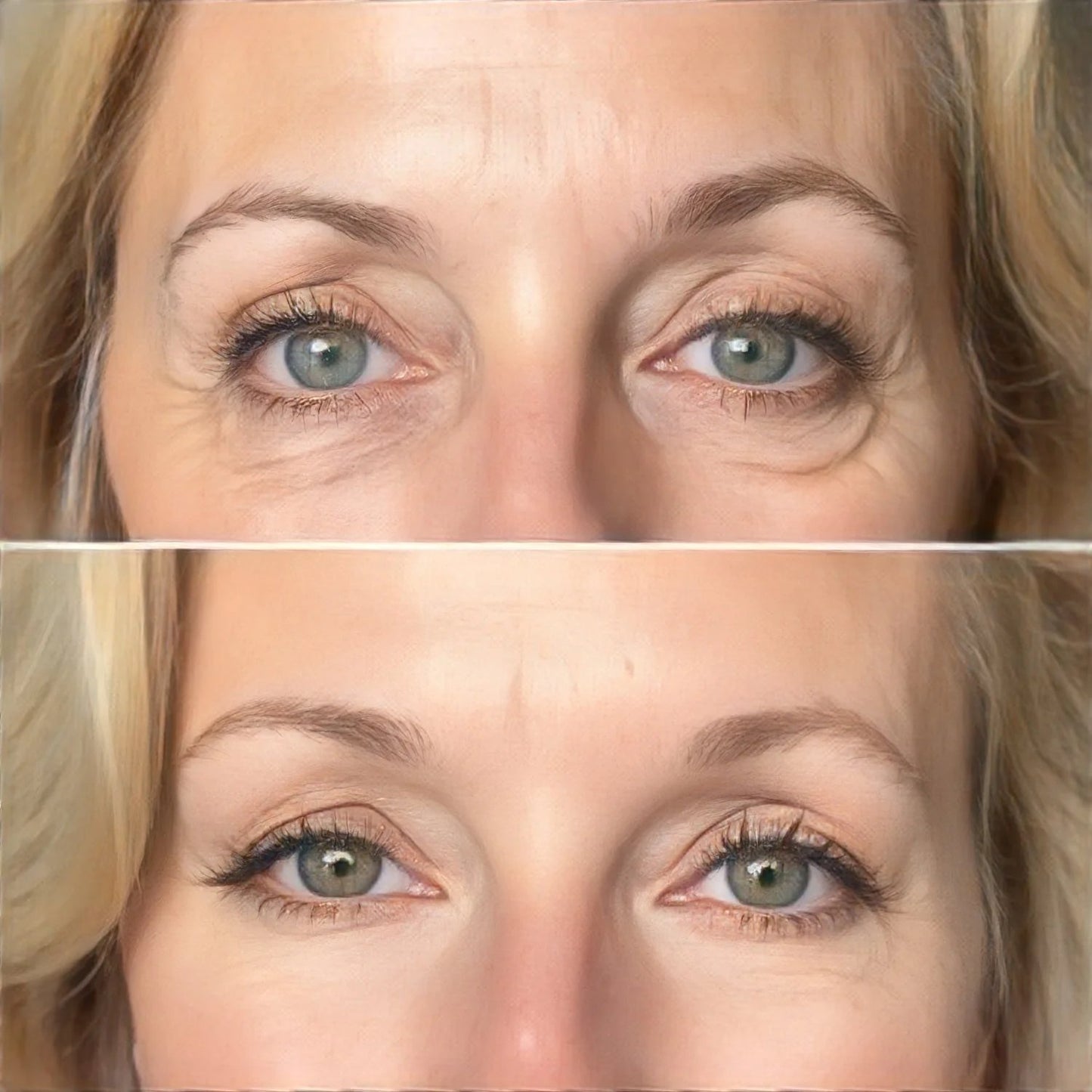 ✨Peptide Hydrogel Eye Patch | 60 Pairs · K-Beauty Eye Revival Essential👁️