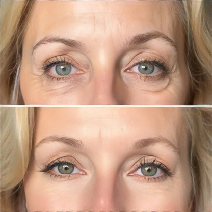 ✨Peptide Hydrogel Eye Patch | 60 Pairs · K-Beauty Eye Revival Essential👁️